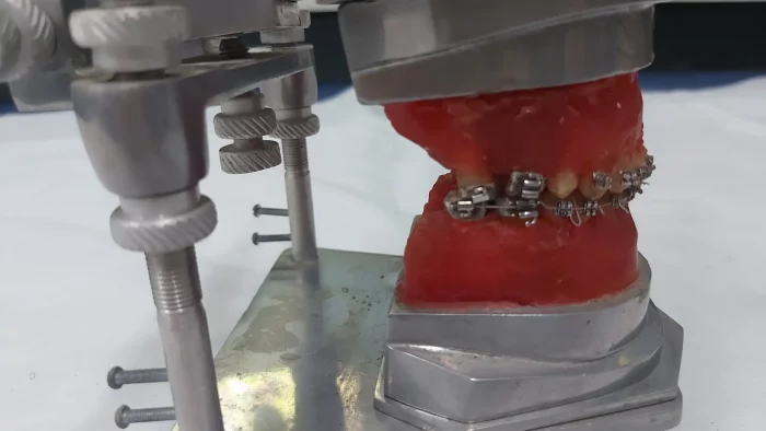 Typodont de Metal Articulado com Dentes