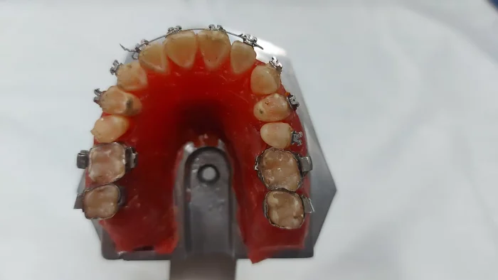 Typodont de Metal Articulado com Dentes